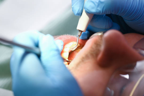 Best Walk-In Emergency Dentist in Bourbon, MO