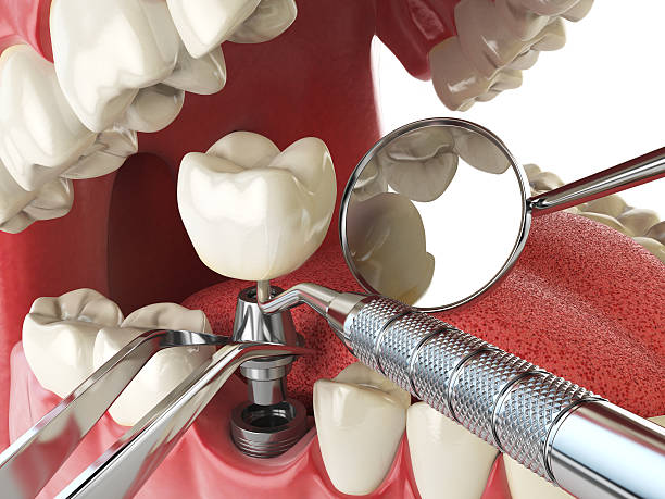 Best Emergency Orthodontic Repairs in Bourbon, MO
