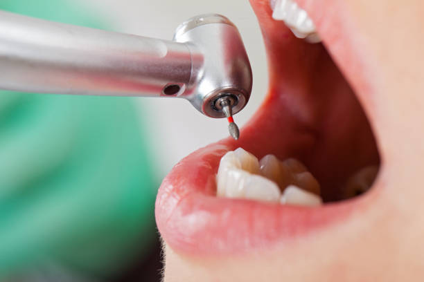 Best After-Hours Emergency Dentist in Bourbon, MO